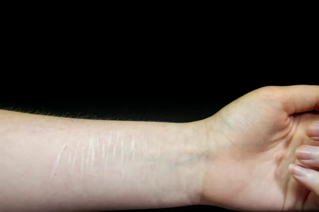 Samookaleczanie nie zawsze jest grzechem - co mówi Kościół i Biblia