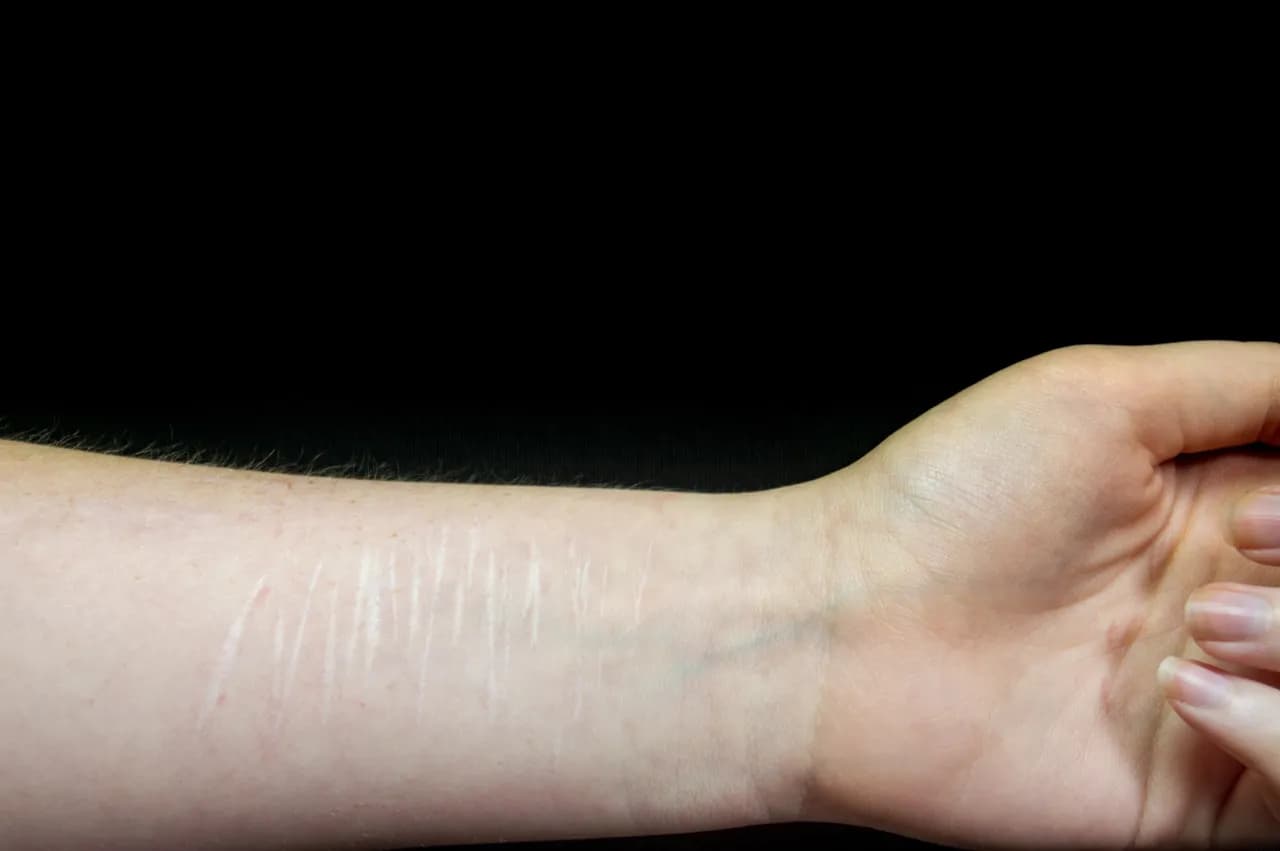 Samookaleczanie nie zawsze jest grzechem - co mówi Kościół i Biblia